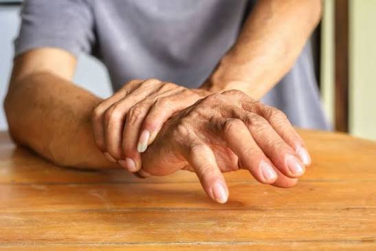 Tremblements, fourmillements et faiblesse d’un bras : quand faut-il consulter en urgence ?